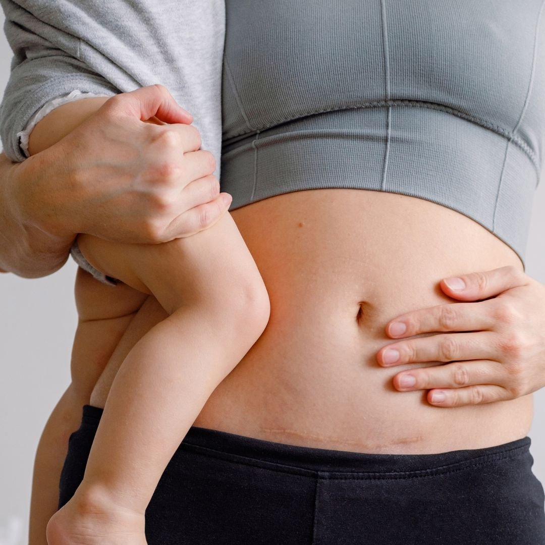 Hansı doğuş üsulunu seçməliyəm?